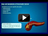 Symptoms of pancreatic cancer