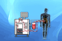 HIPEC circulation system